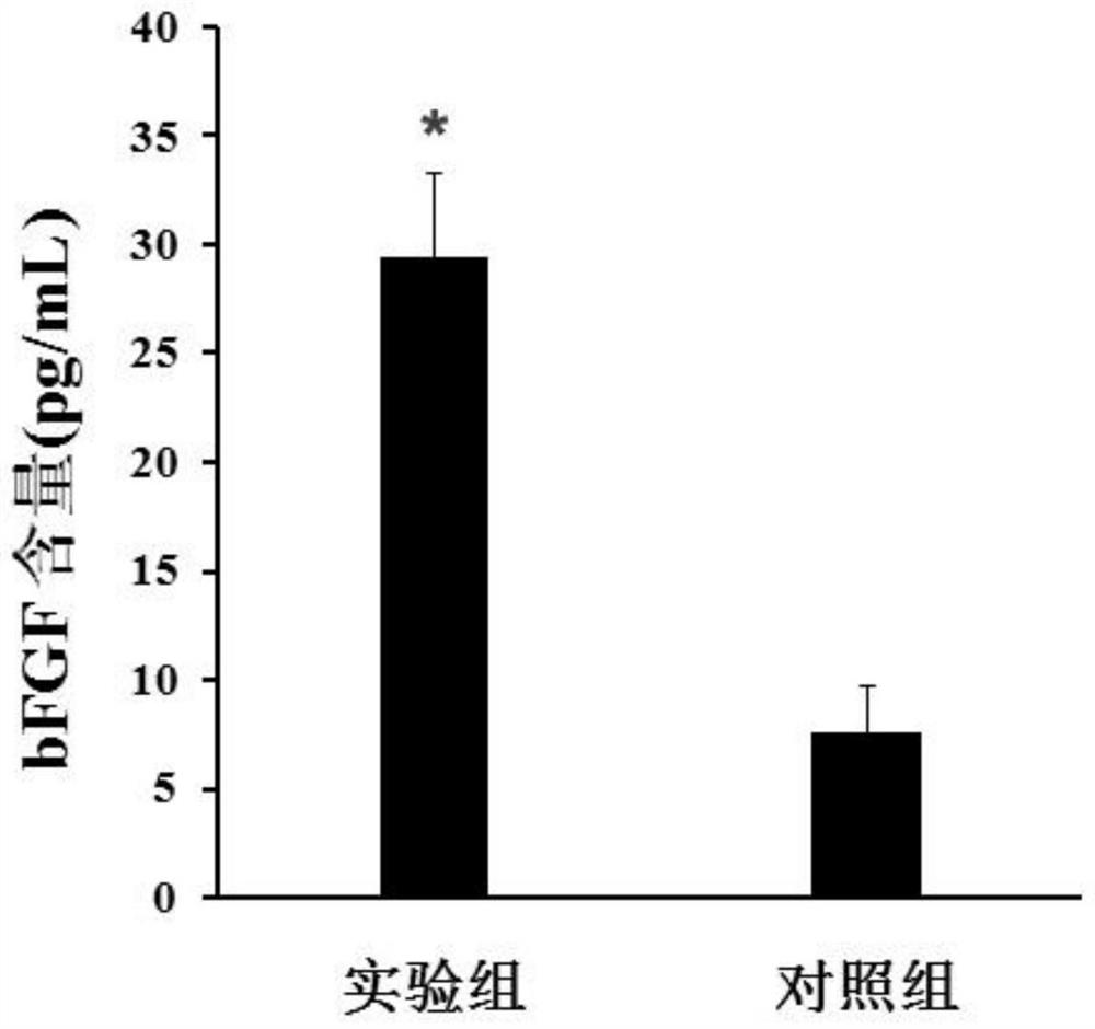 Preparation method of biogel and biogel prepared by preparation method