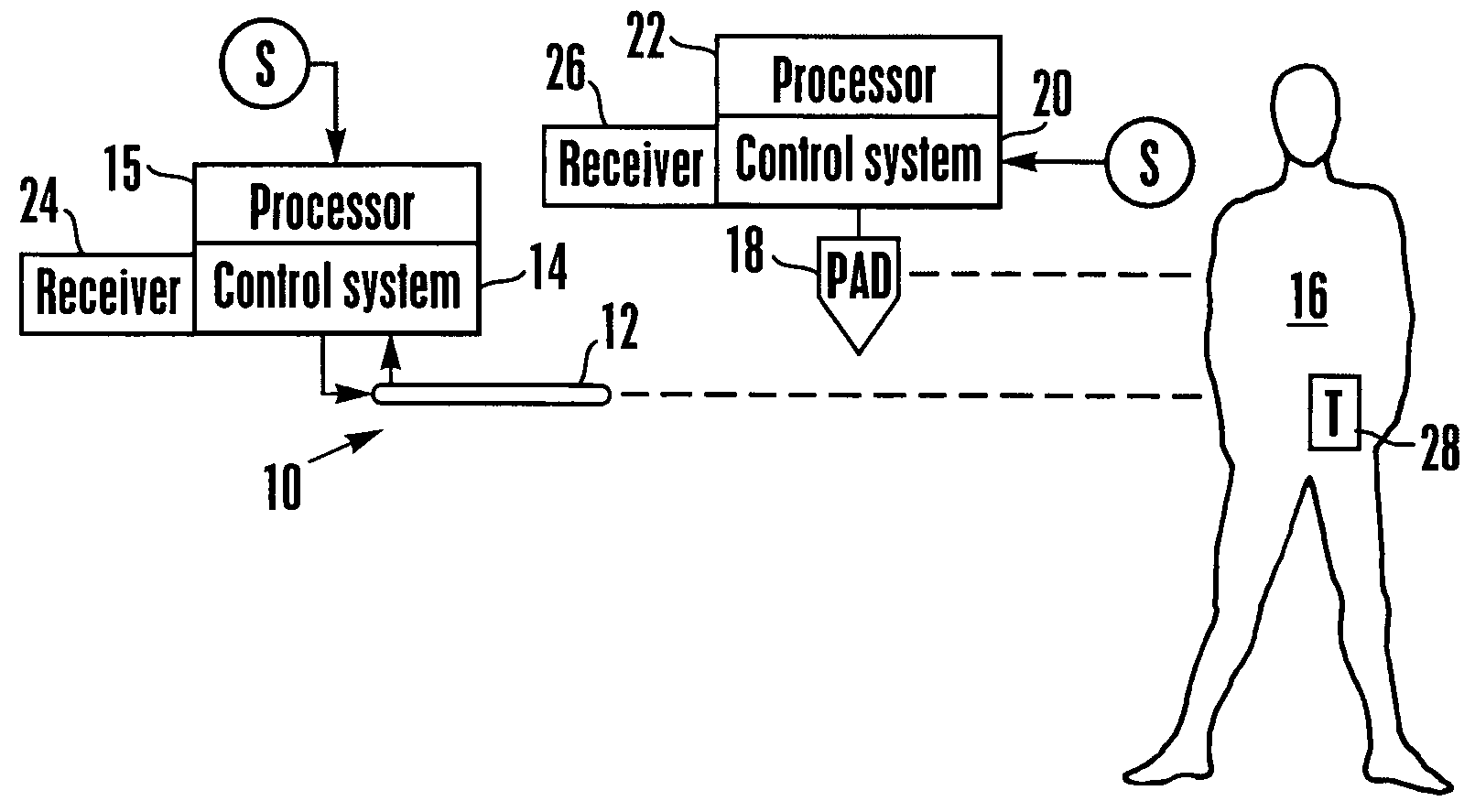 Temperature management system with wireless patient temperature sensor