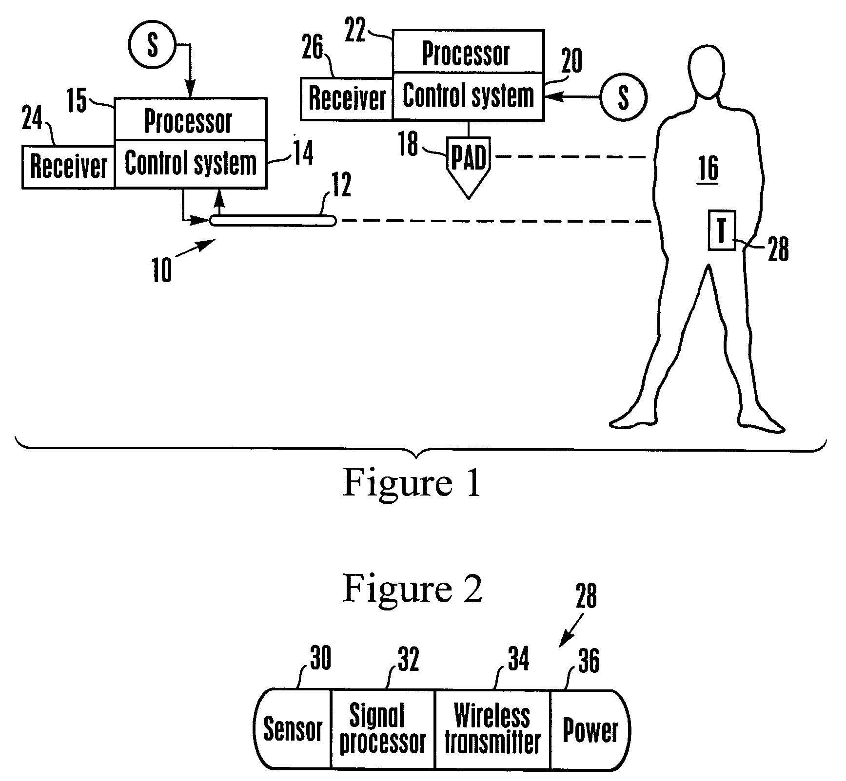 Temperature management system with wireless patient temperature sensor