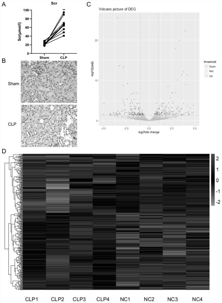 Application of tifa inhibitor in the preparation of medicine for treating and/or preventing sepsis acute kidney injury