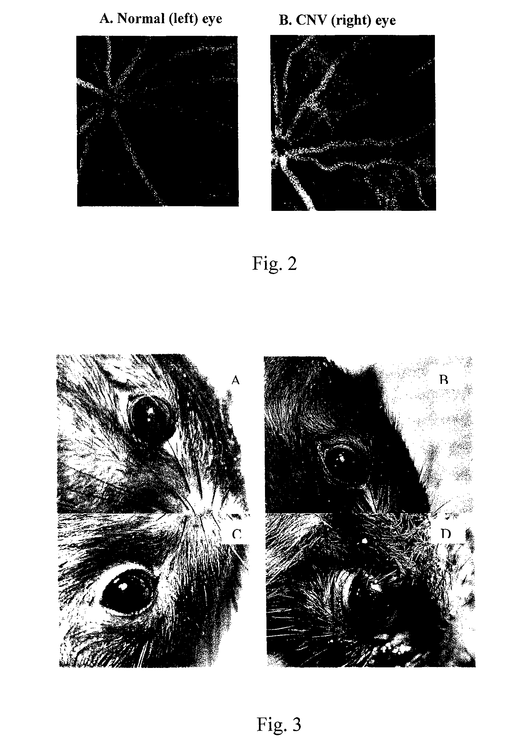 Liposome composition for delivery of a therapeutic agent to eyes