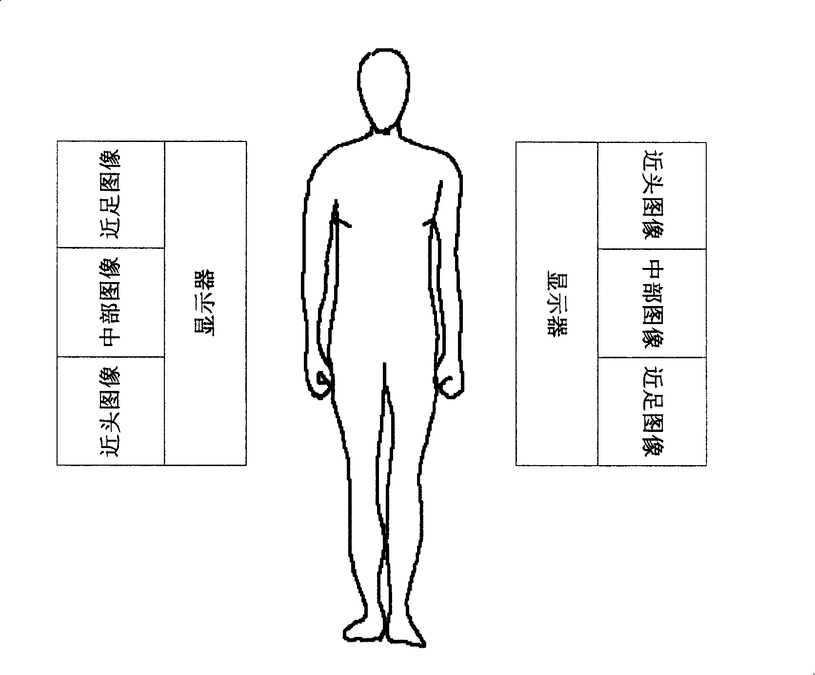 Method of displaying image in CT interventional therapy