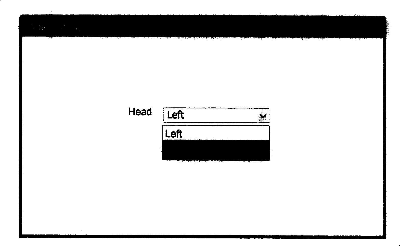 Method of displaying image in CT interventional therapy