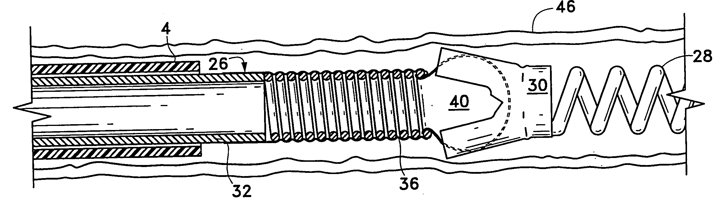 Implant delivery assembly with expandable coupling/decoupling mechanism