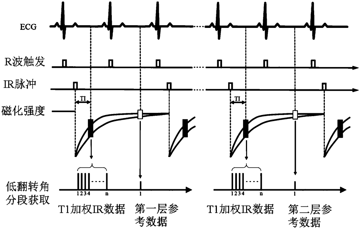 Magnetic resonance imaging method and system