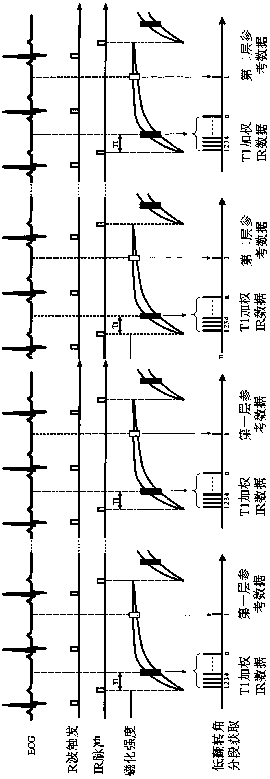 Magnetic resonance imaging method and system