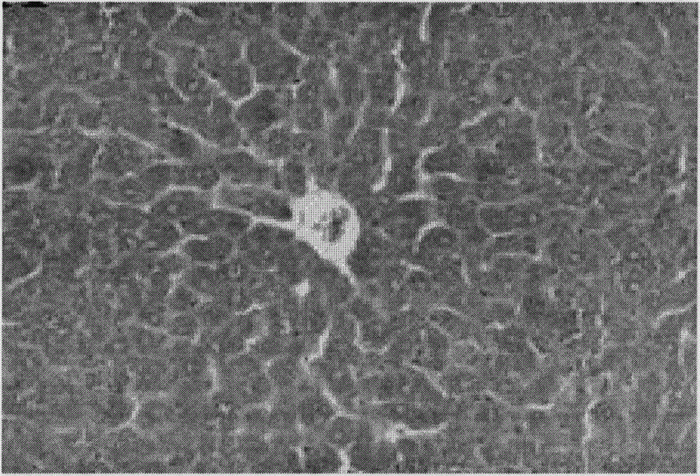 Tibetan artemisia capillaris extract and preparation method, drug composition and application thereof