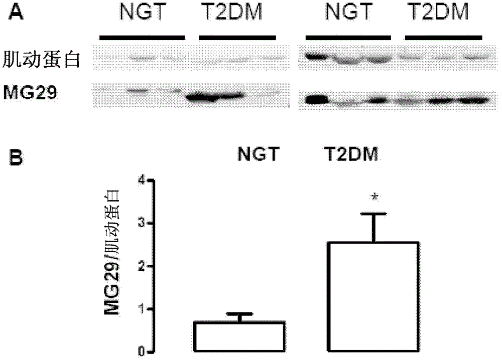 Compositions and methods for modulating mg29 for the treatment of diabetes