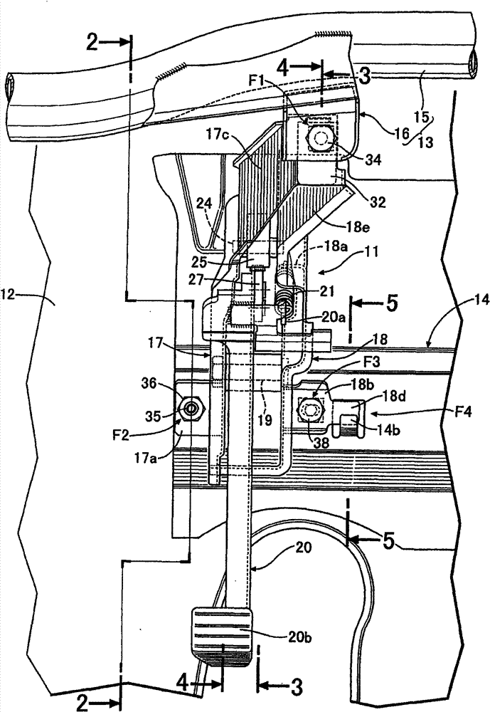 Fixed structure of pedal support