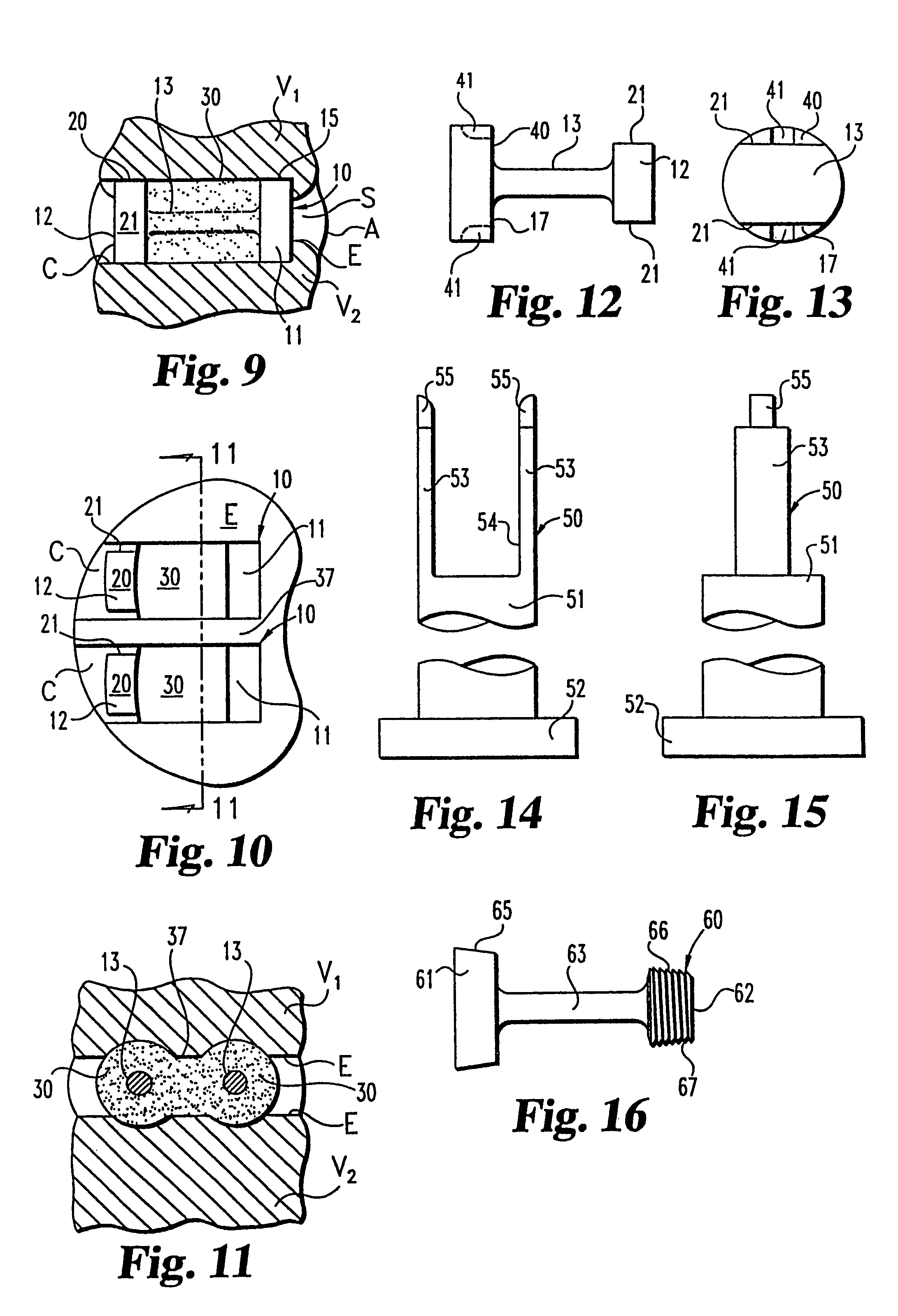 Osteogenic fusion device