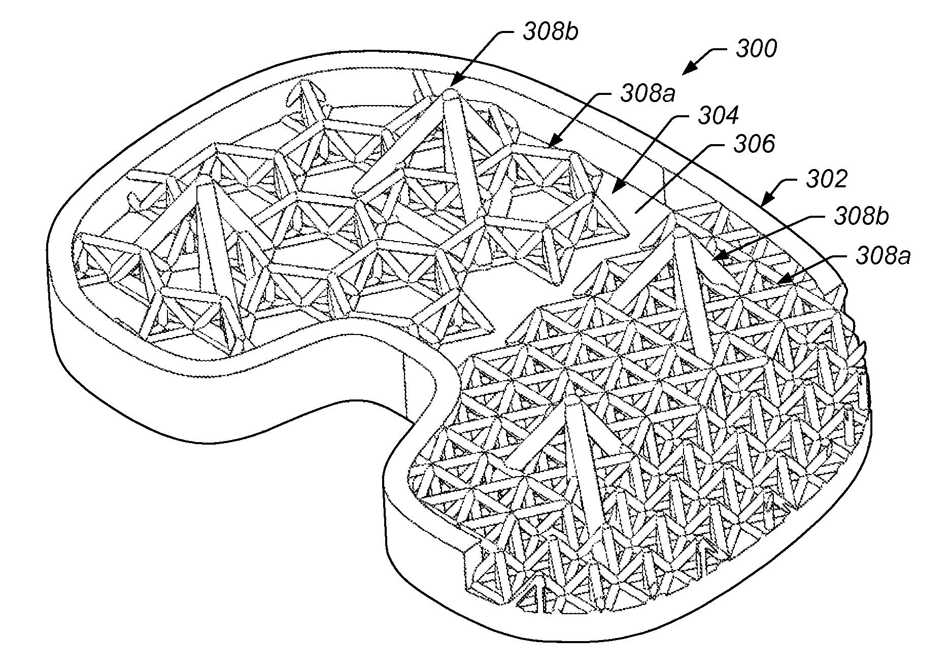 Implant interface system and method