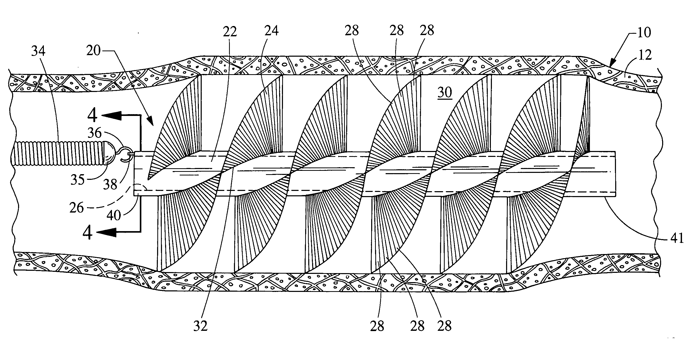 Embolic protection device