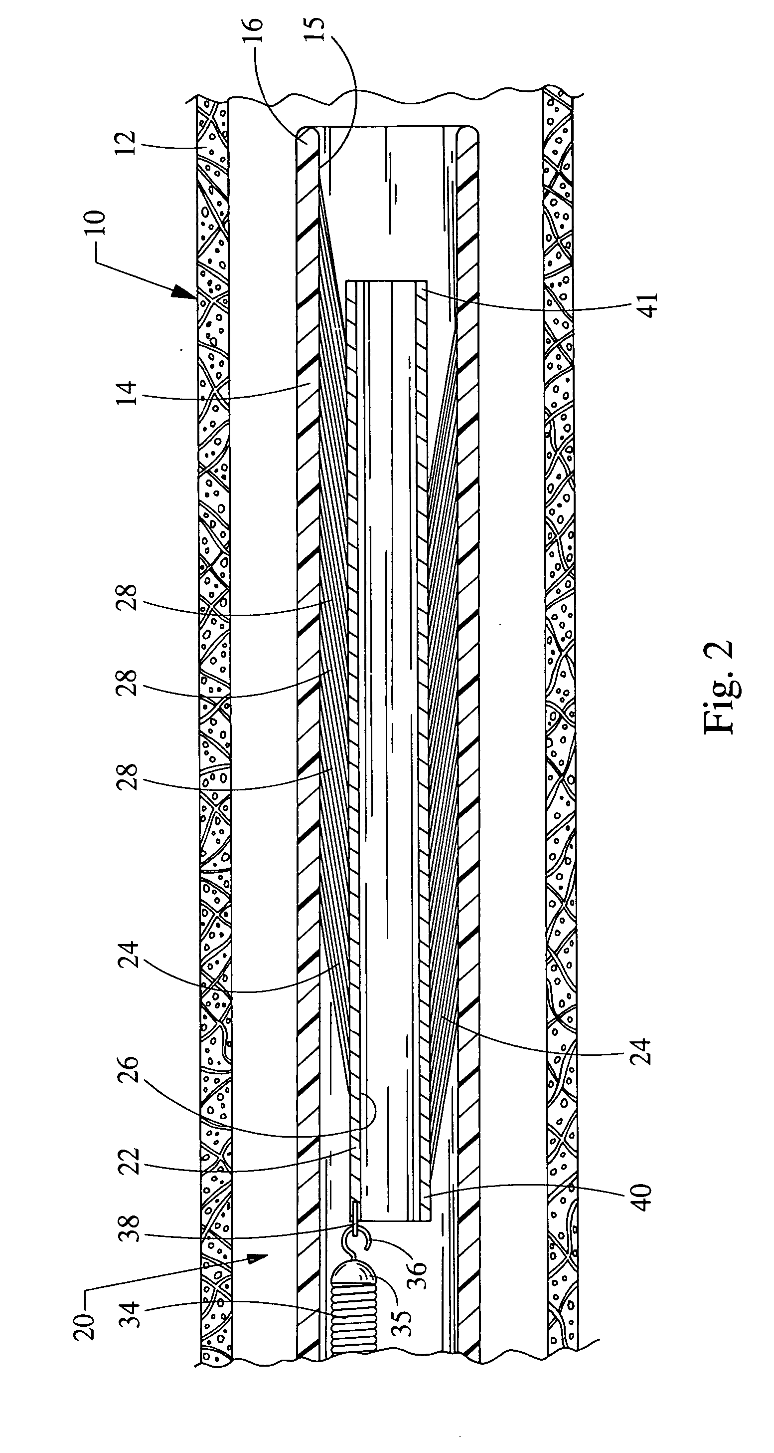 Embolic protection device