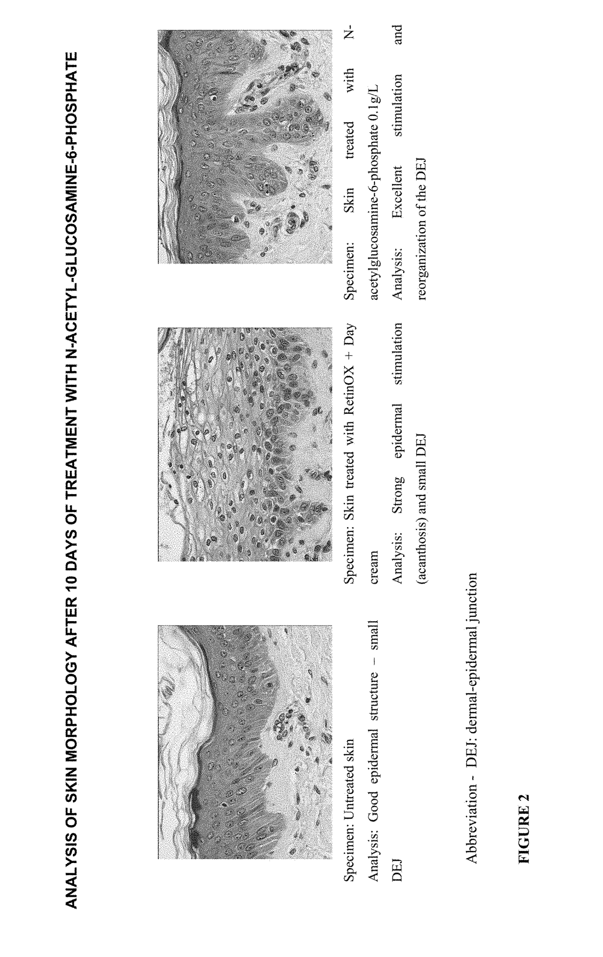 Cosmetic and pharmaceutical composition comprising N-acetylglucosamine-6-phosphate