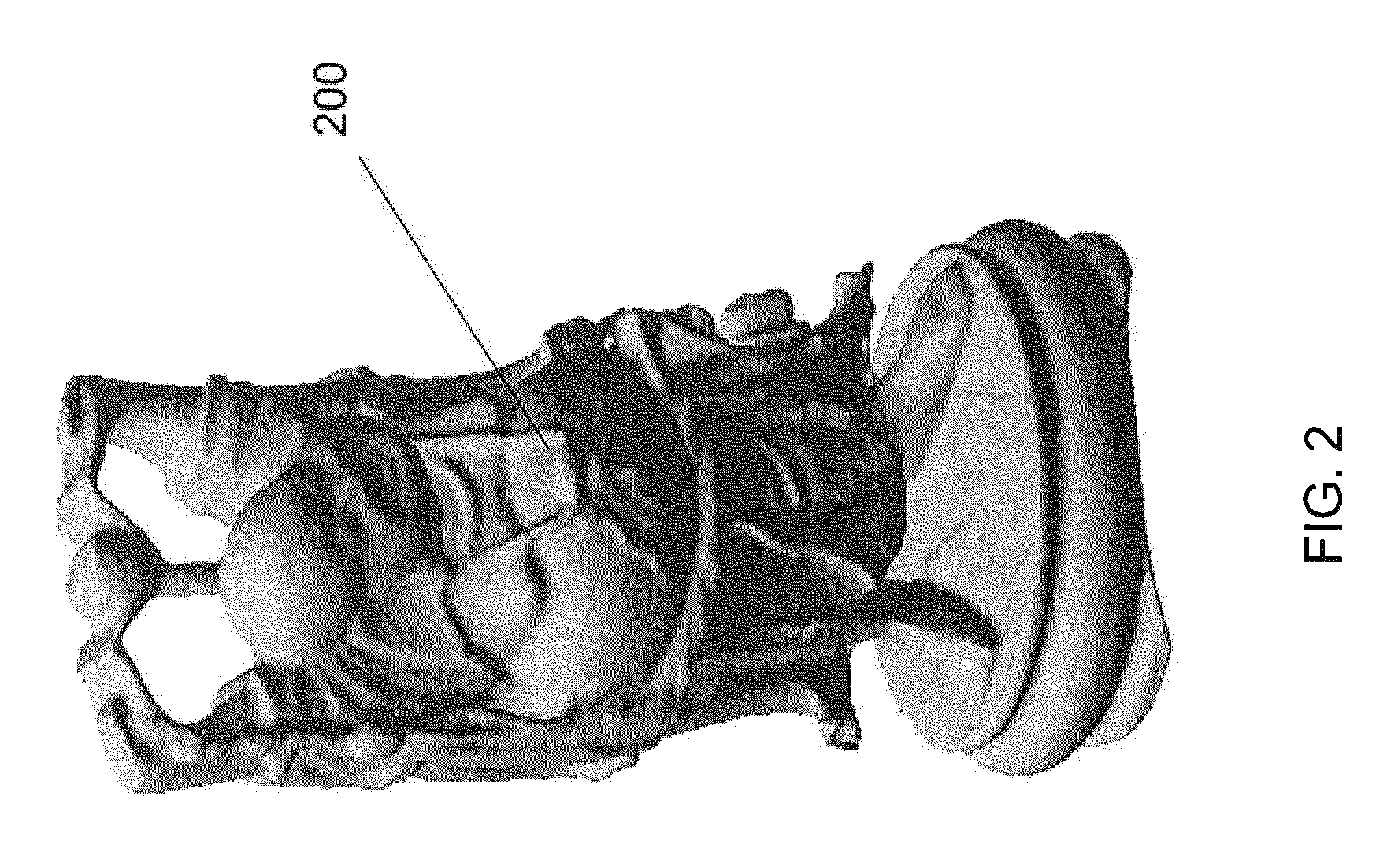 Method and apparatus for accurate compression and decompression of three-dimensional point cloud data