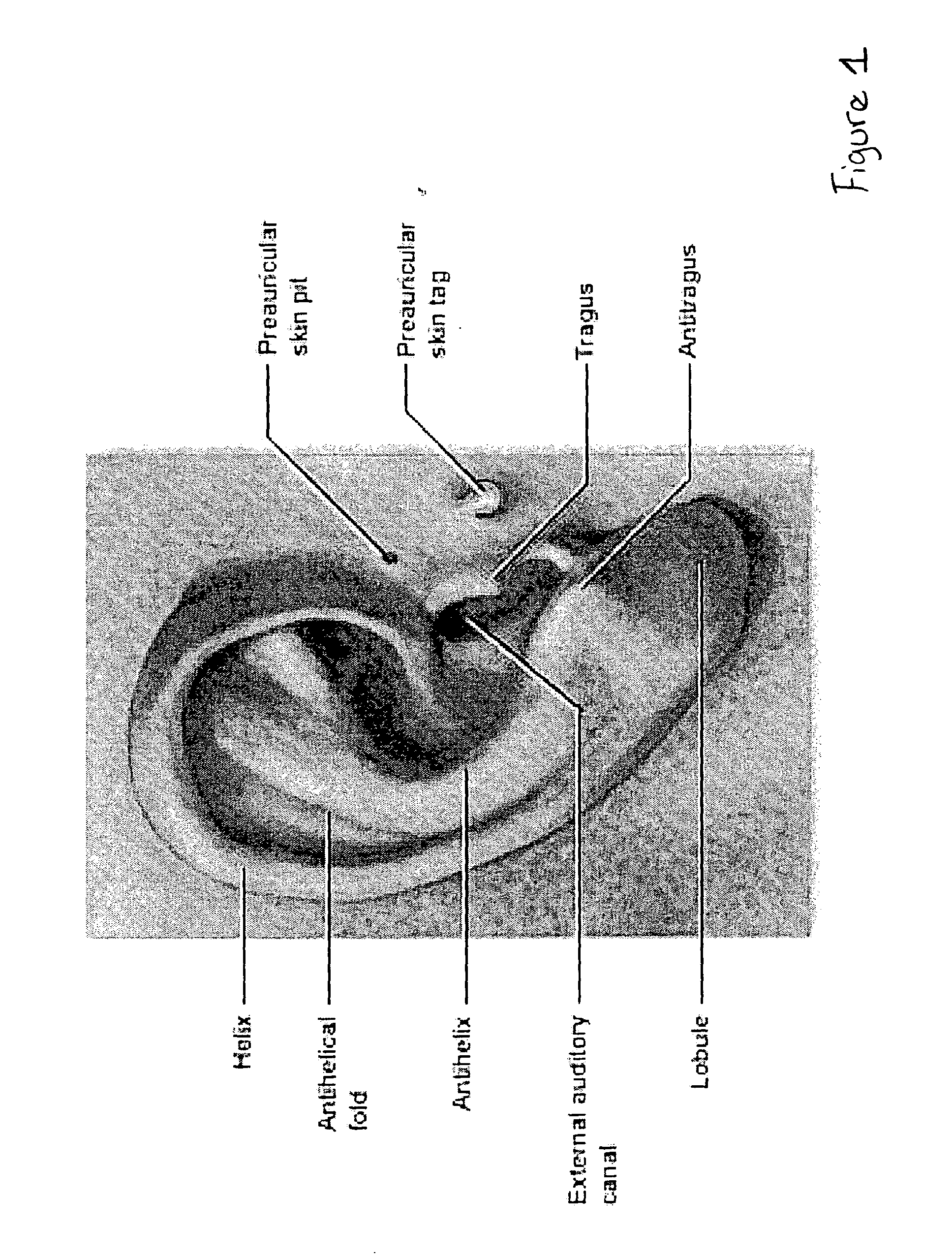 Non-invasive blood glucose monitoring system