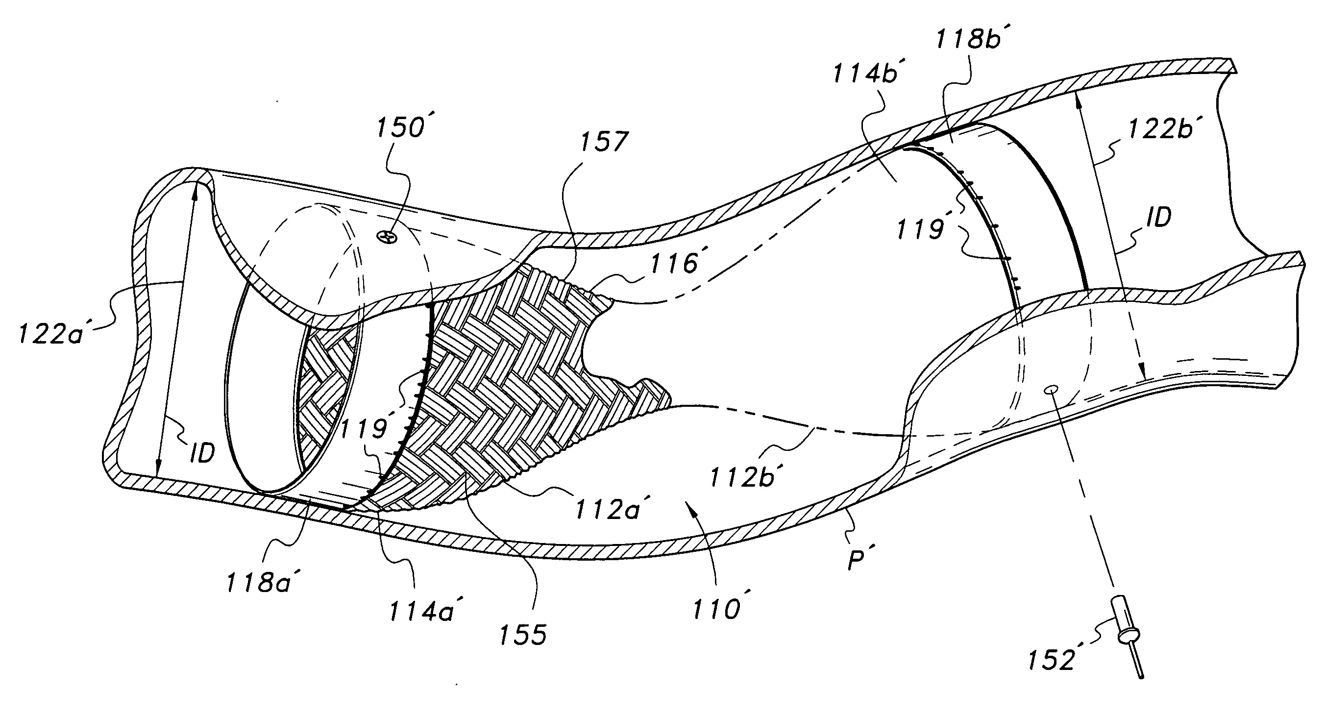 Inserts for engine exhaust systems