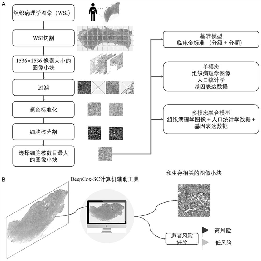 Stomach cancer patient survival risk prediction method based on histopathology image and gene expression data