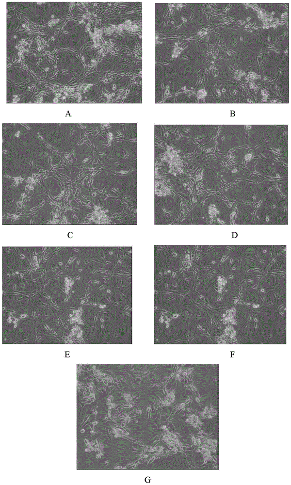 Chondrocyte culture medium and chondrocyte culture method