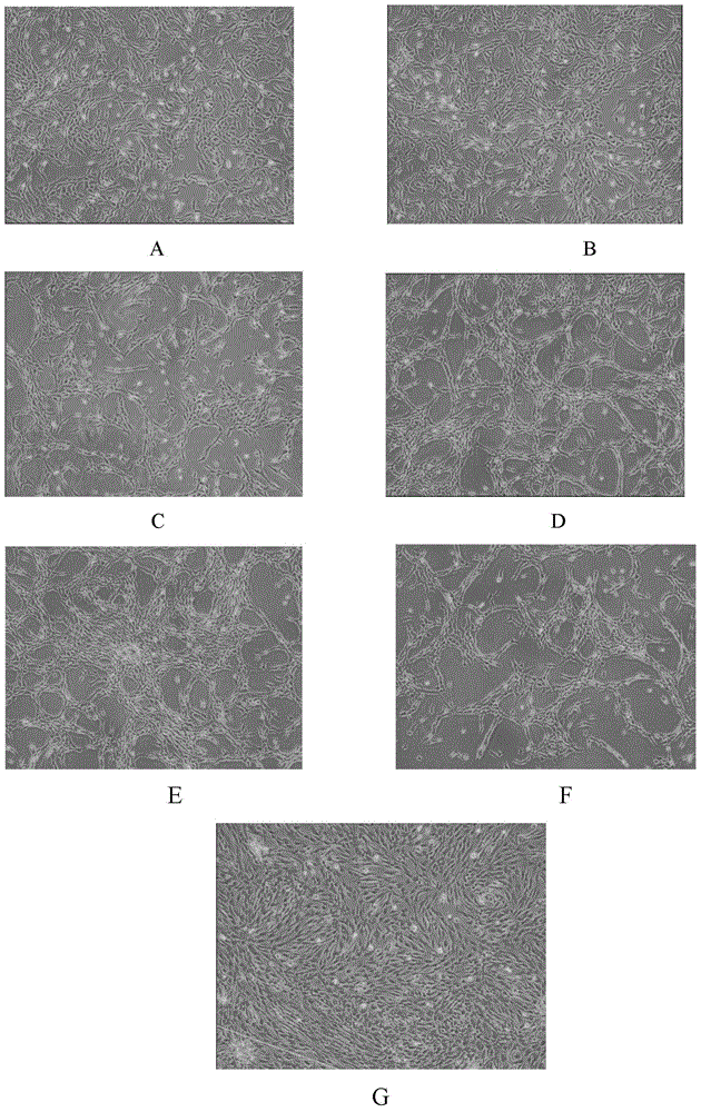 Chondrocyte culture medium and chondrocyte culture method