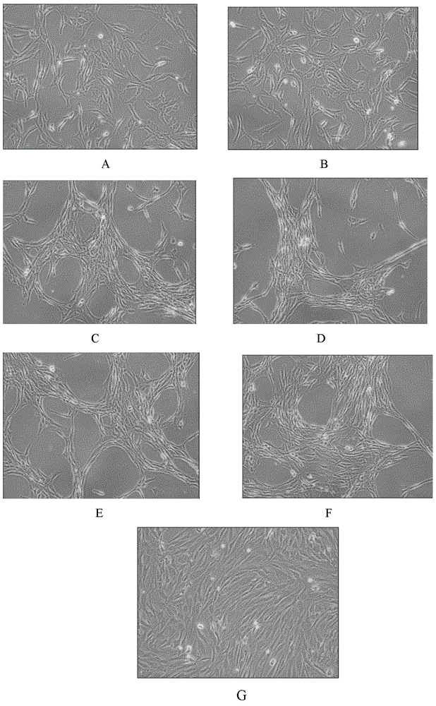 Chondrocyte culture medium and chondrocyte culture method