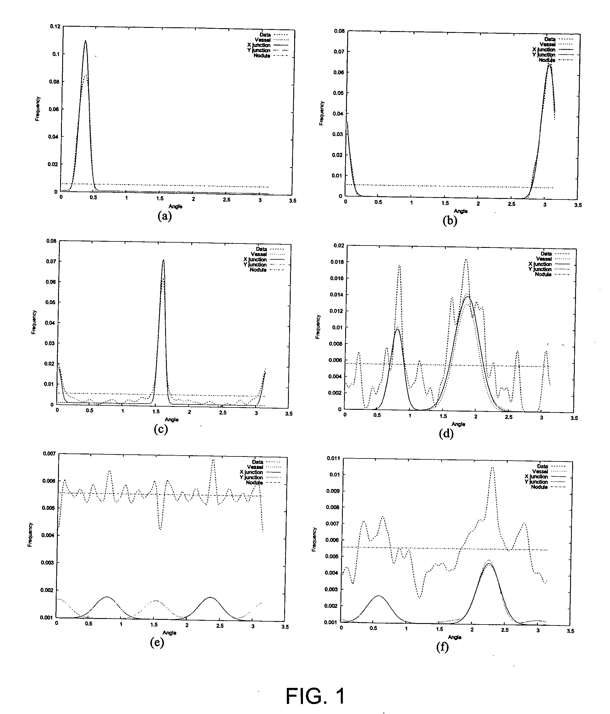 Method for enhancing diagnostic images using vessel reconstruction