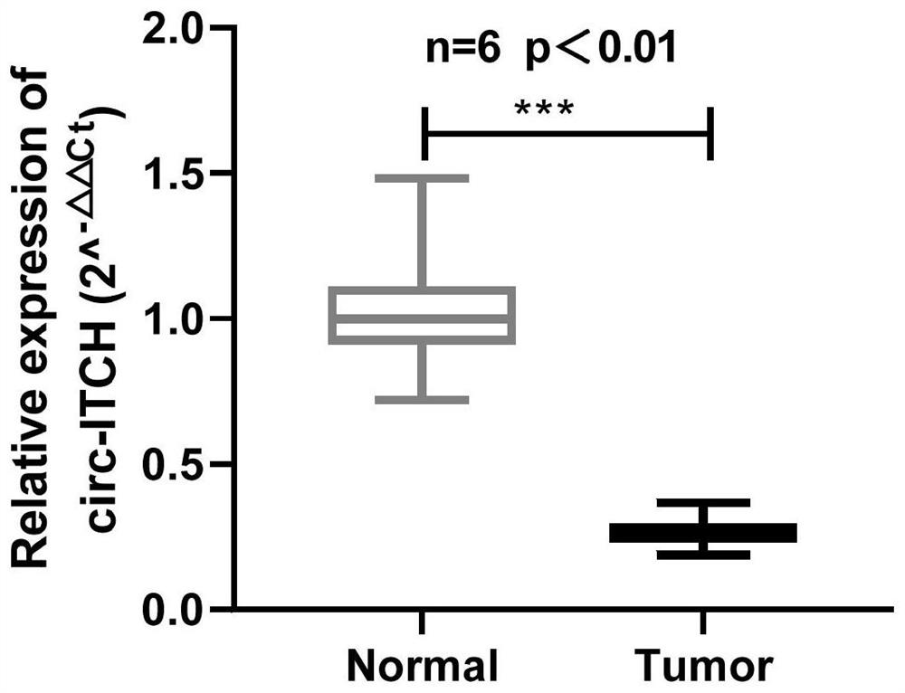 Pharmaceutical composition containing circ-ITCH and application thereof