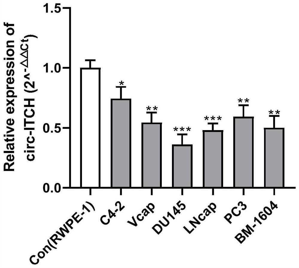 Pharmaceutical composition containing circ-ITCH and application thereof