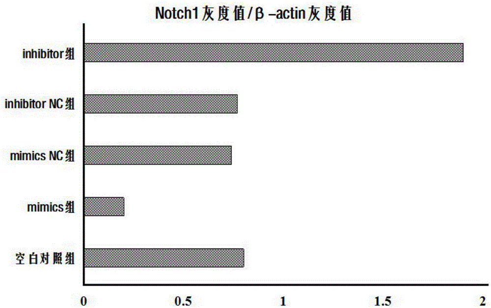 Application of miR-34a and target gene NOTCH1 to preparation of mesenchymal stem cell based glioma targeting carrier