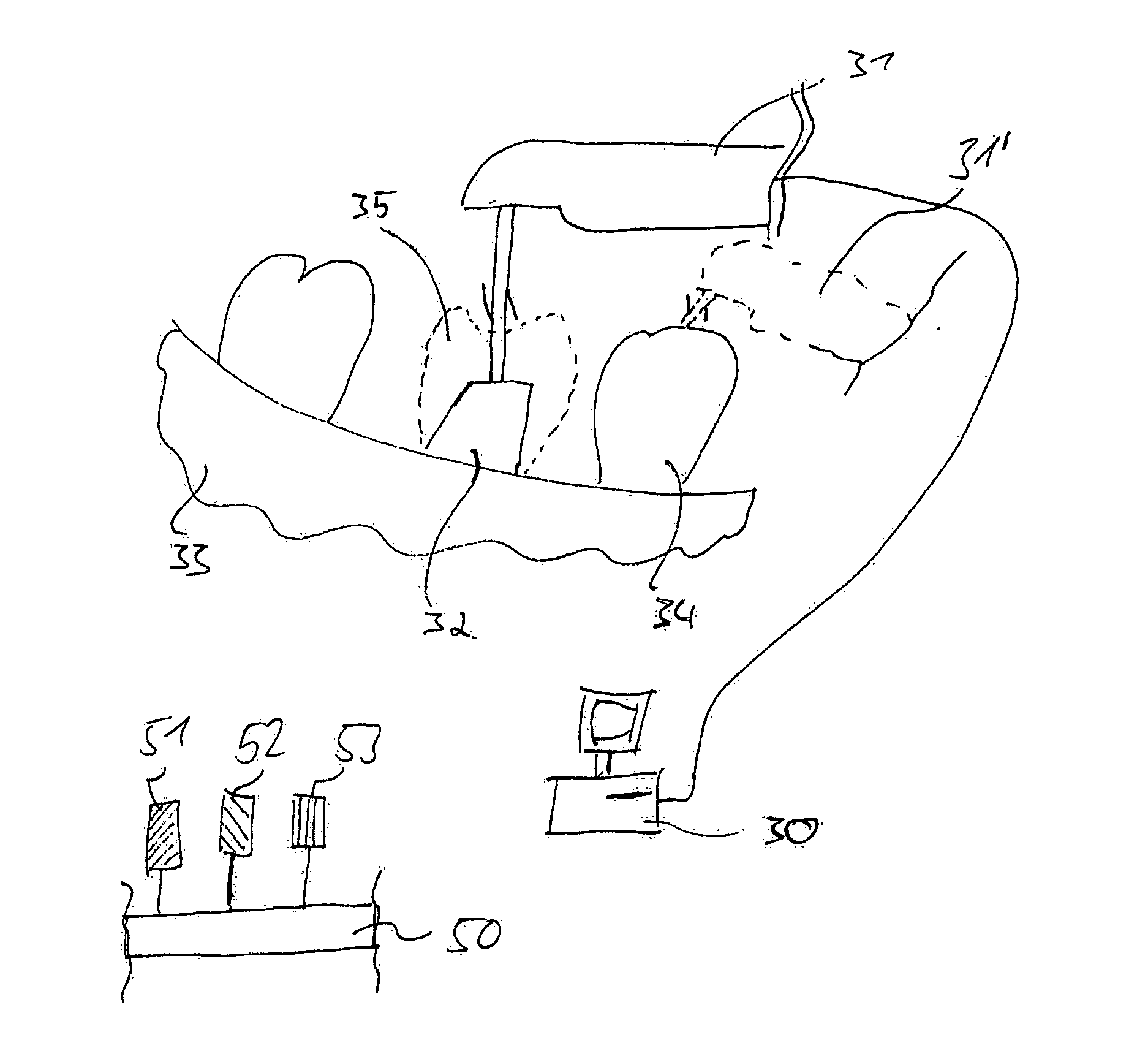 Method and apparatus for selecting non-opacious dental materials