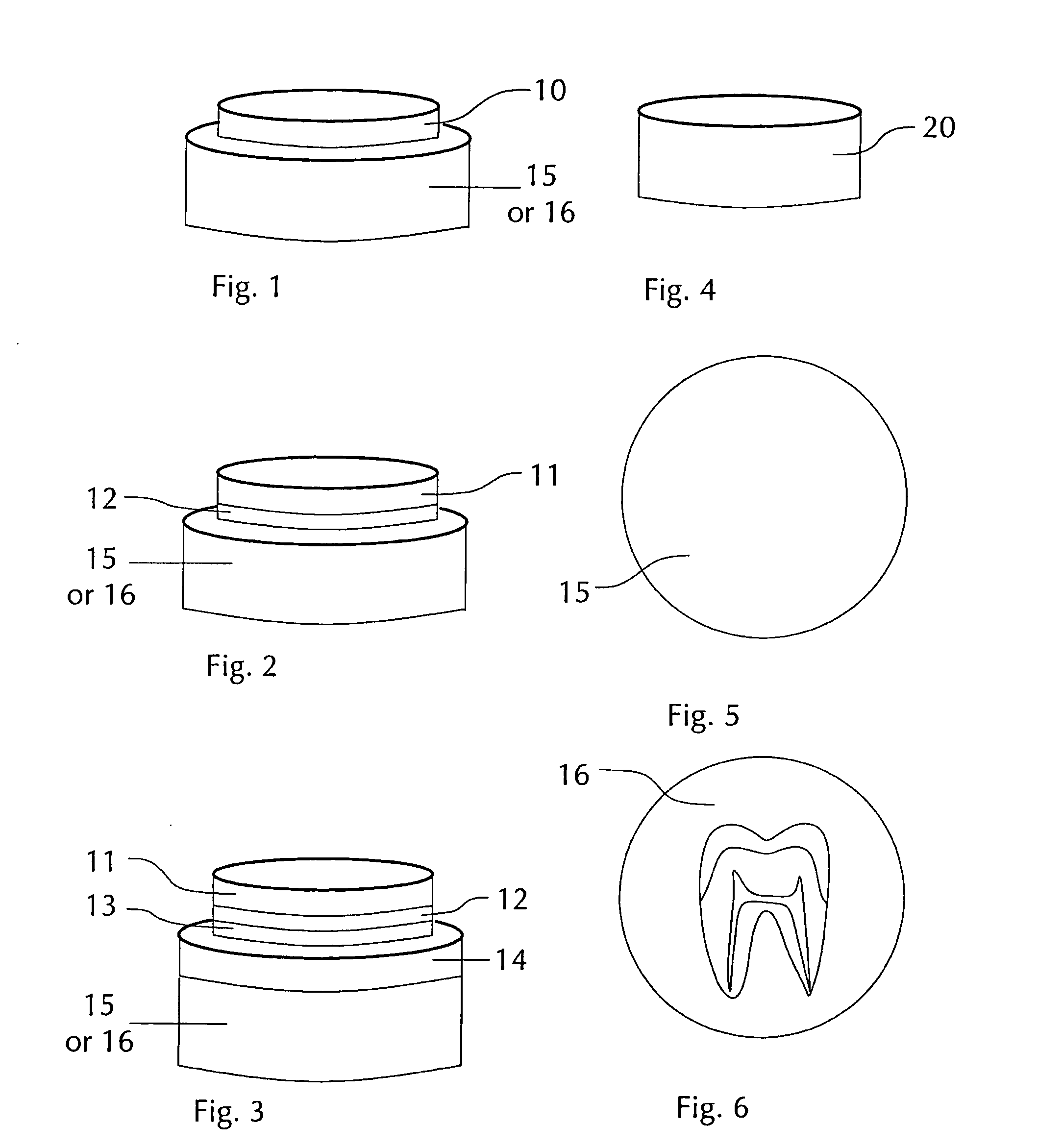 Method and apparatus for selecting non-opacious dental materials