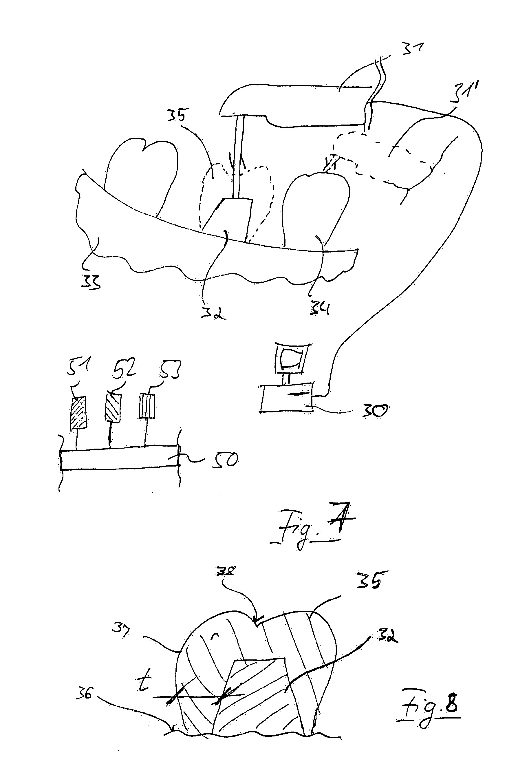 Method and apparatus for selecting non-opacious dental materials