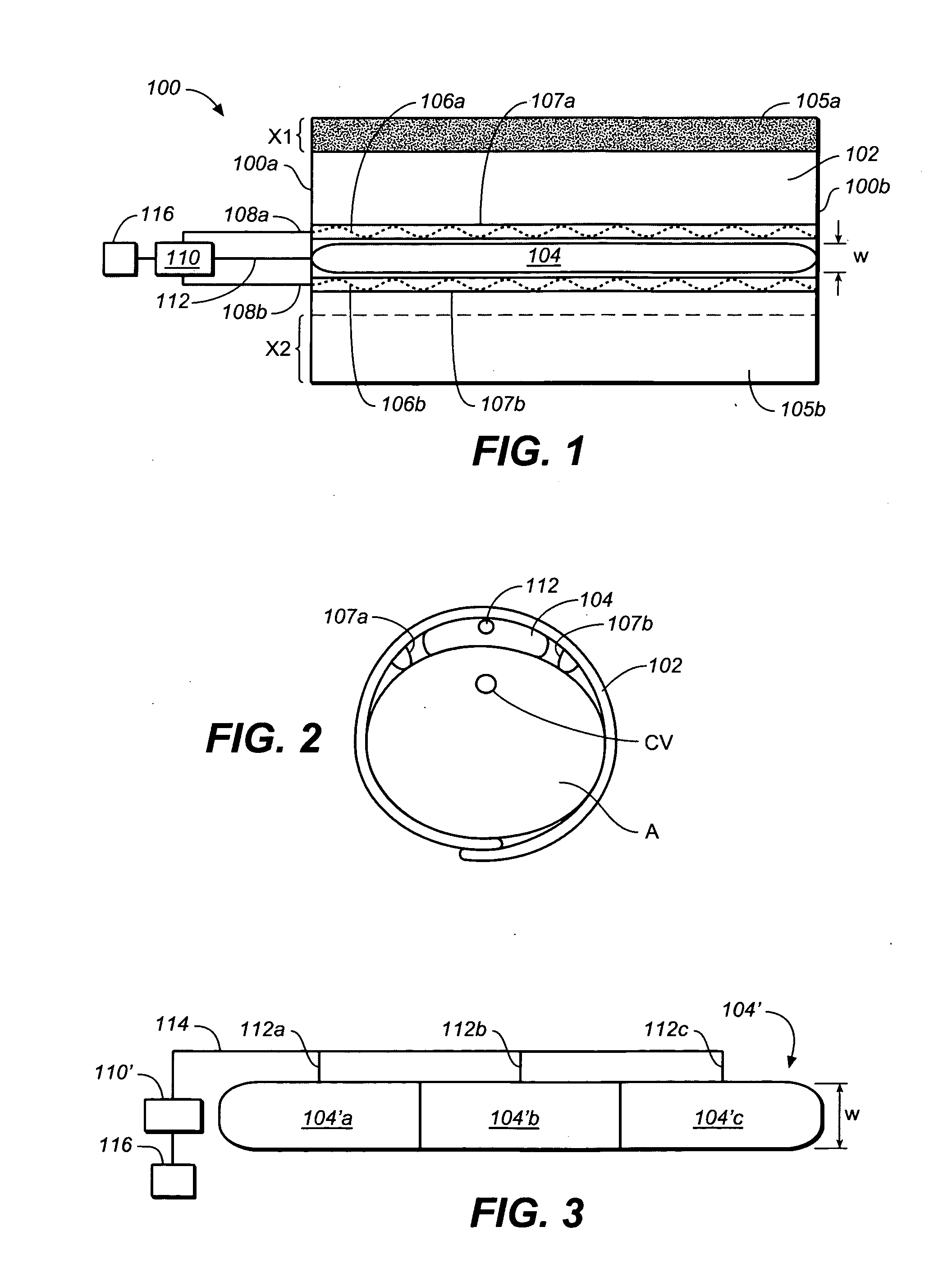 Hemodialysis vein preparation apparatus and methods