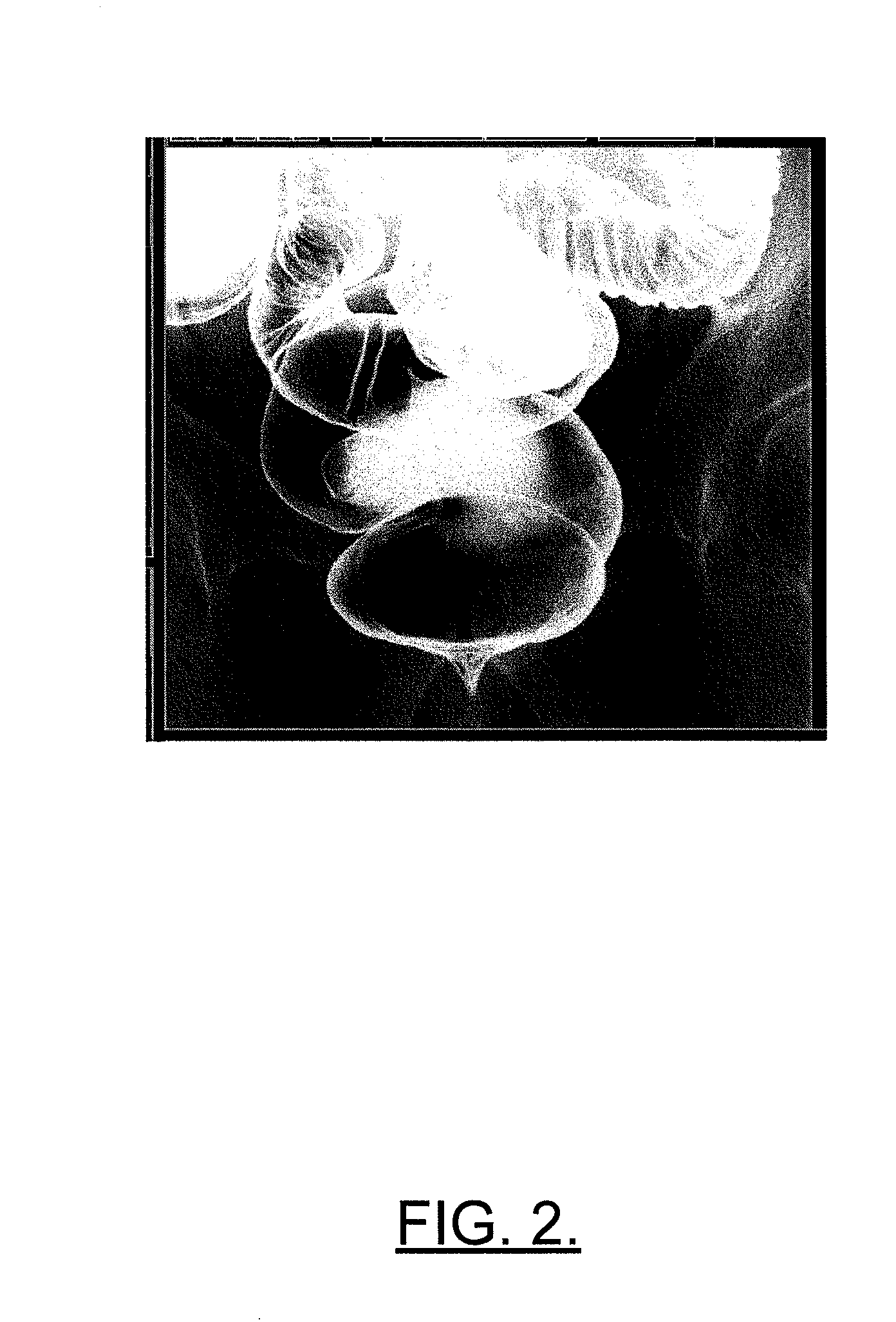 Methods, computer program products, apparatuses, and systems to accommodate decision support and reference case management for diagnostic imaging