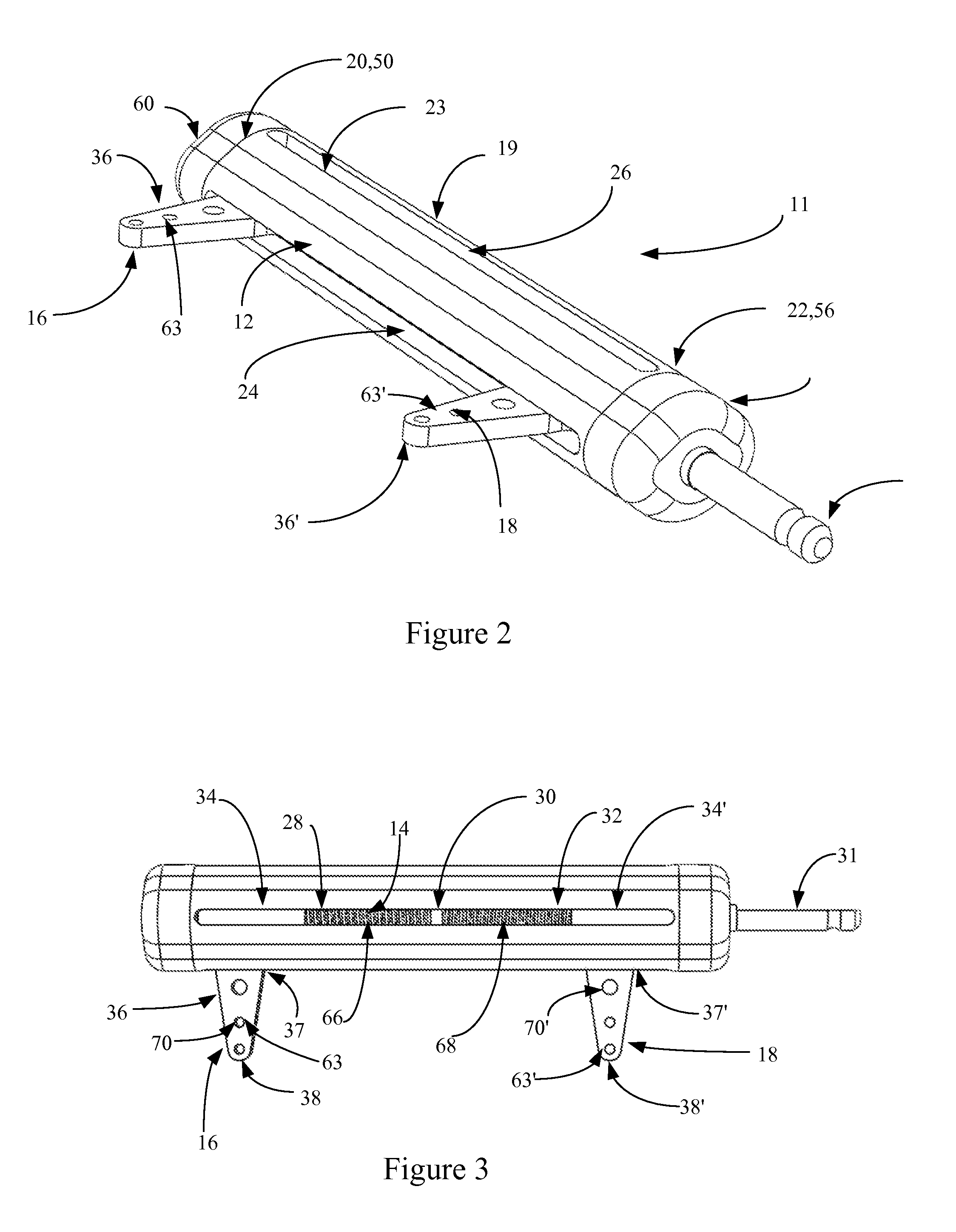 Bone Compression and Distraction System