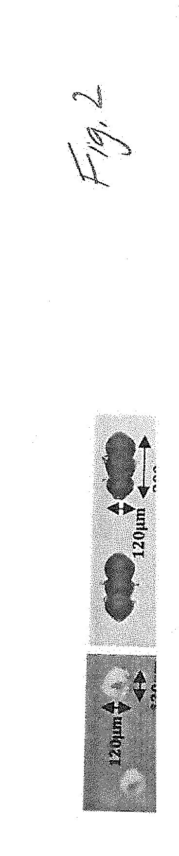 Method and apparatus for directional skin tightening