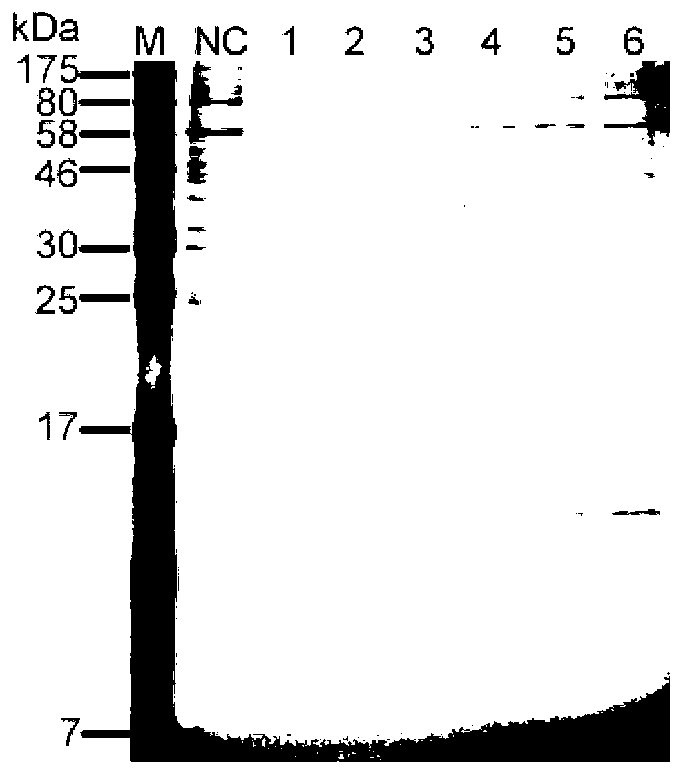 Recombinant expression vector for human beta-NGF and recombinant cell strain containing same