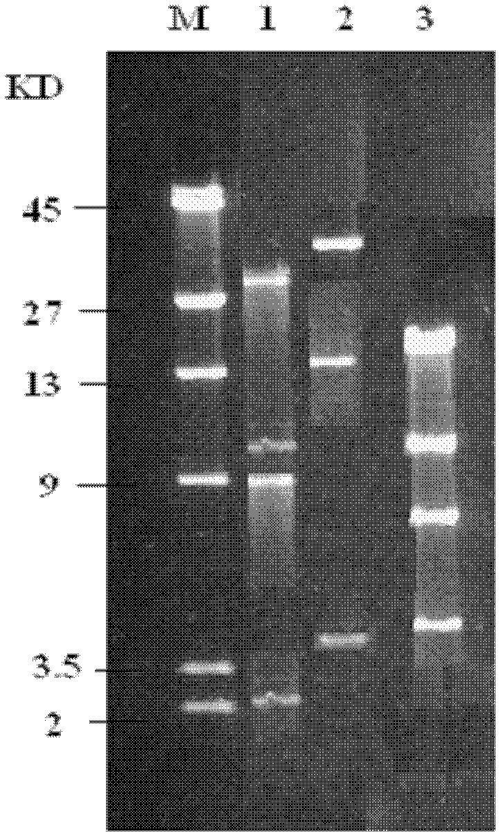 Chlorinated aliphatic hydrocarbon degradative plasmid pRC11, engineered bacteria and application thereof