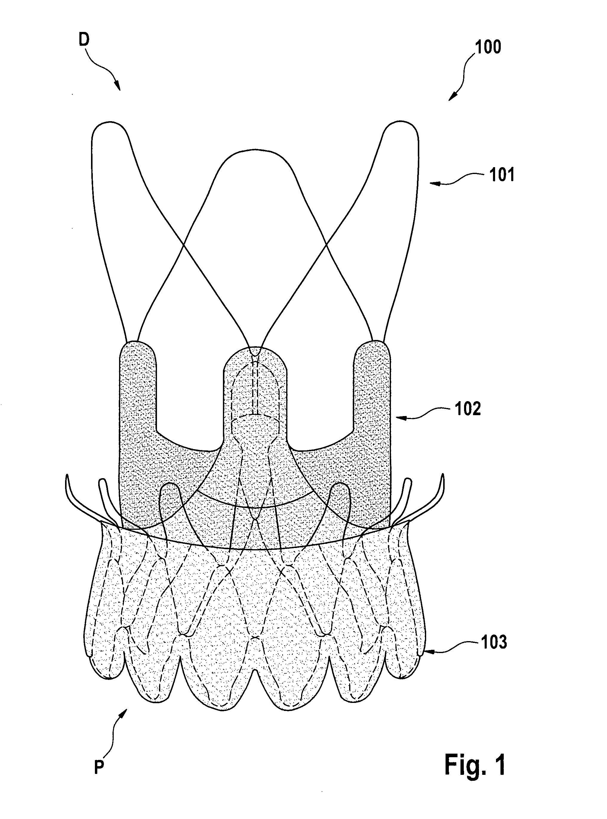 Aortic bioprosthesis and systems for delivery thereof