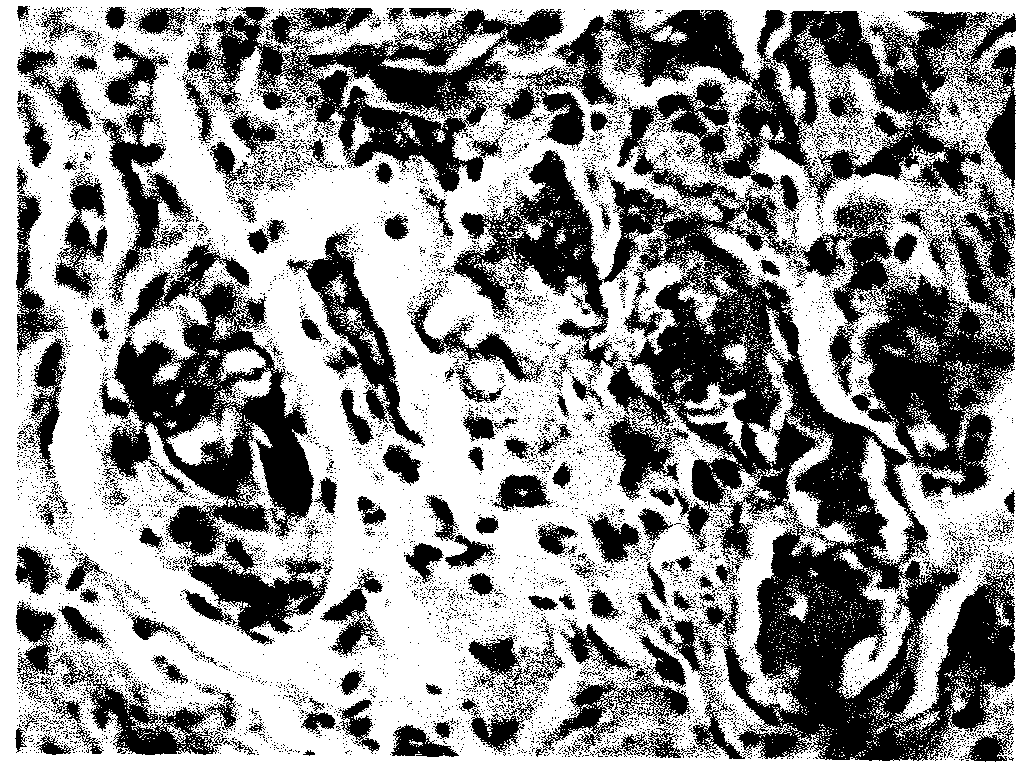 Composite containing collagen and elastin as a dermal expander and tissue filler