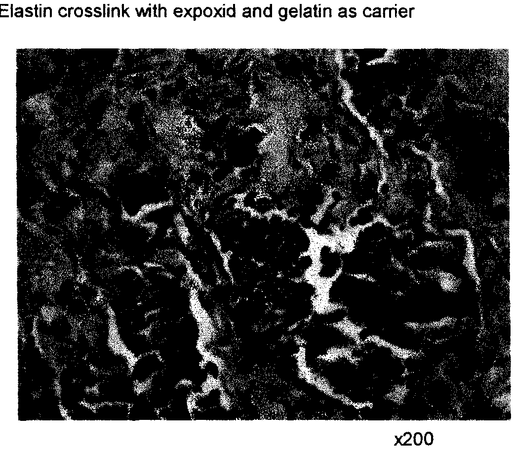 Composite containing collagen and elastin as a dermal expander and tissue filler