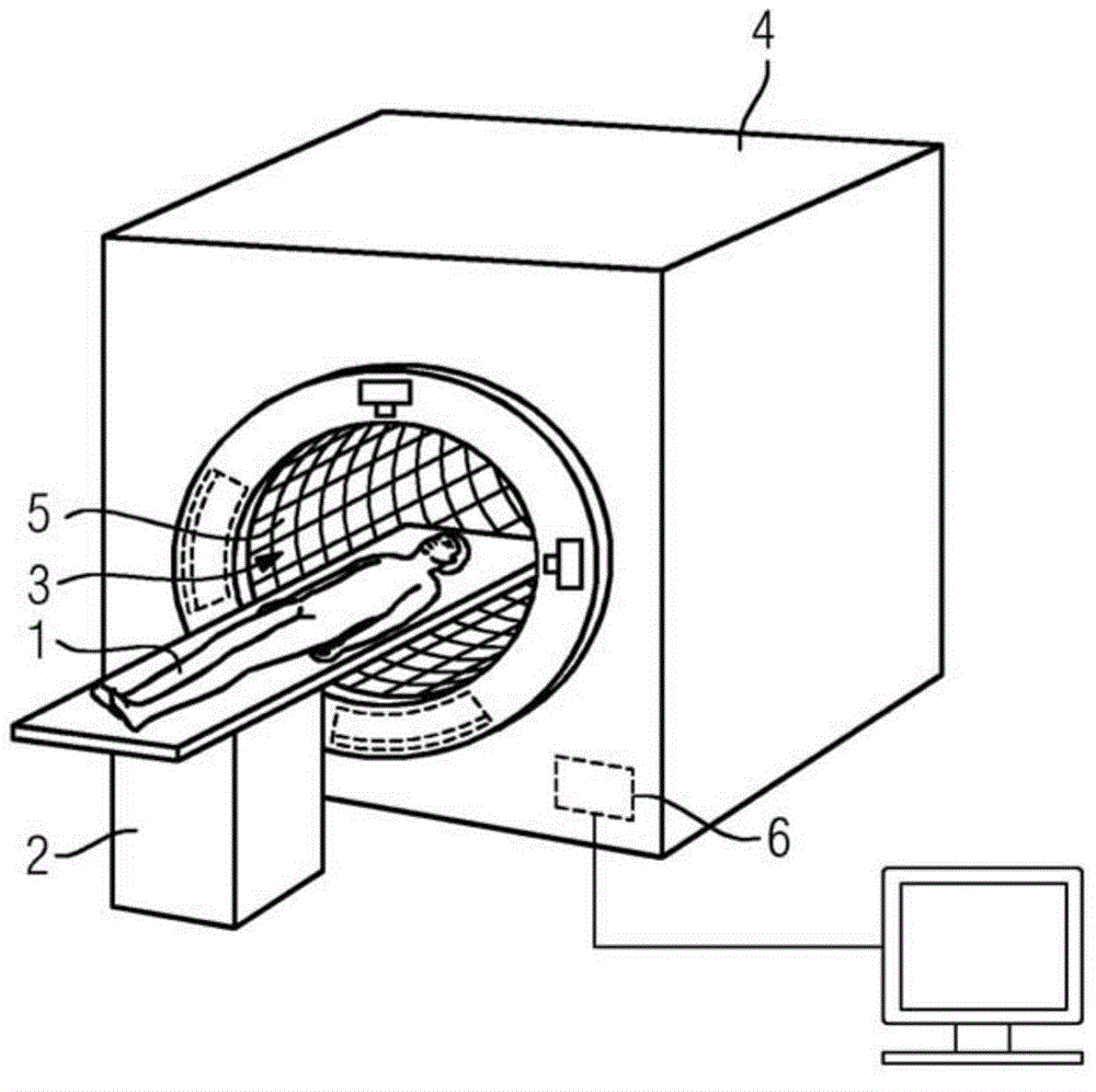 Medical device