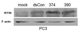 Application of small activating RNA (Ribonucleic Acid) of INTS6 (Homo Sapiens Integrator Complex Subunit 6) gene to preparation of prostate cancer fighting medicament