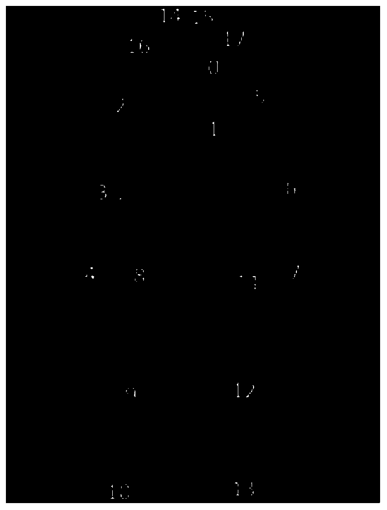 Method and system for detecting psychological abnormalities based on multi-channel collaboration