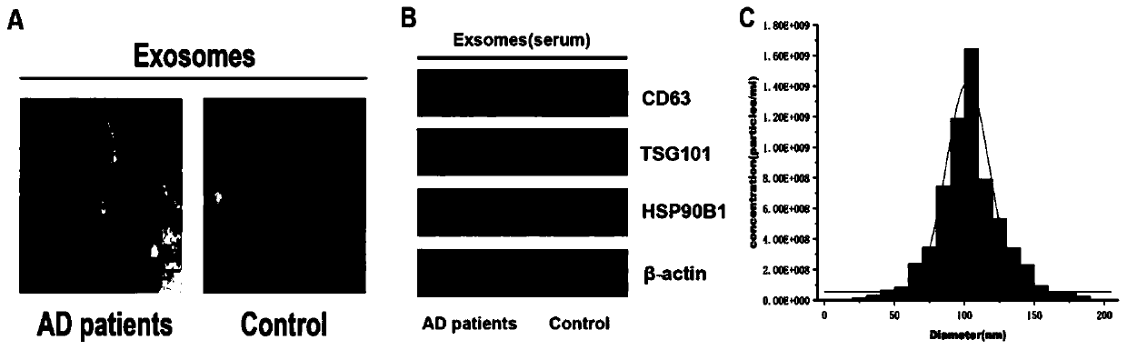 Application of serum exosome has_circ_0004771 in preparation of diagnostic reagent for alcohol dependence syndrome