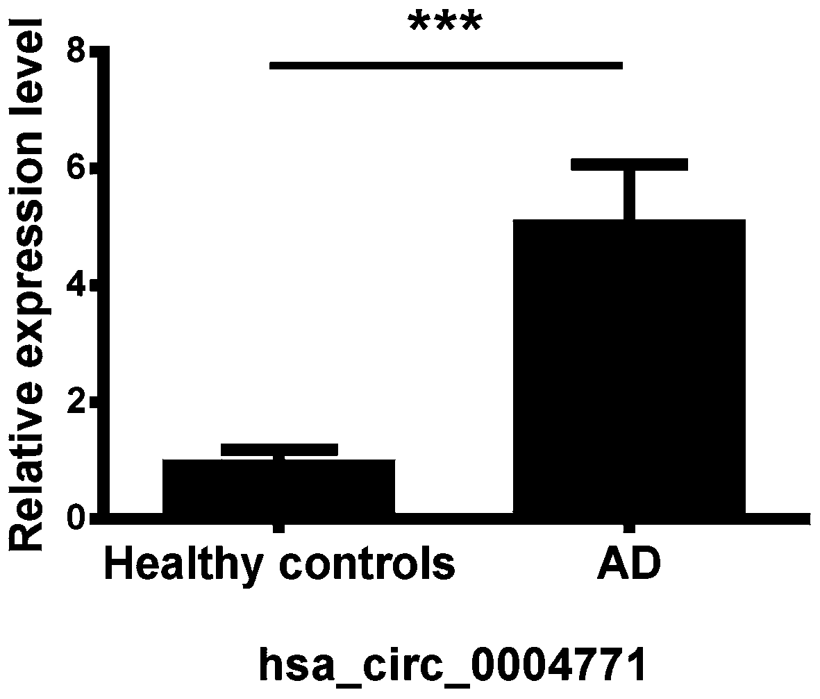 Application of serum exosome has_circ_0004771 in preparation of diagnostic reagent for alcohol dependence syndrome