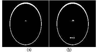 A Sparse Angle X-ray CT Imaging Method