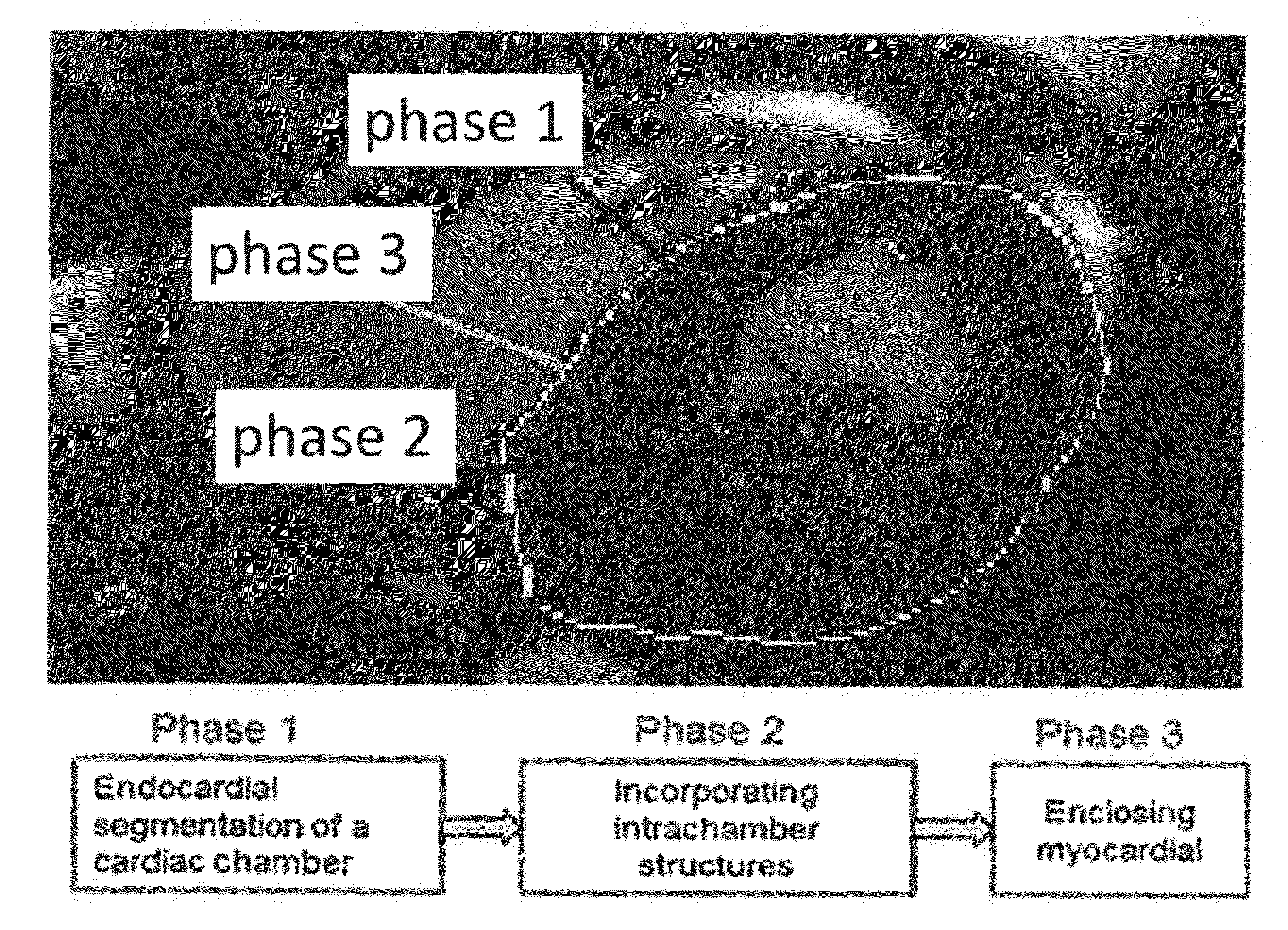 Automated 3D Reconstruction of the Cardiac Chambers from MRI and Ultrasound