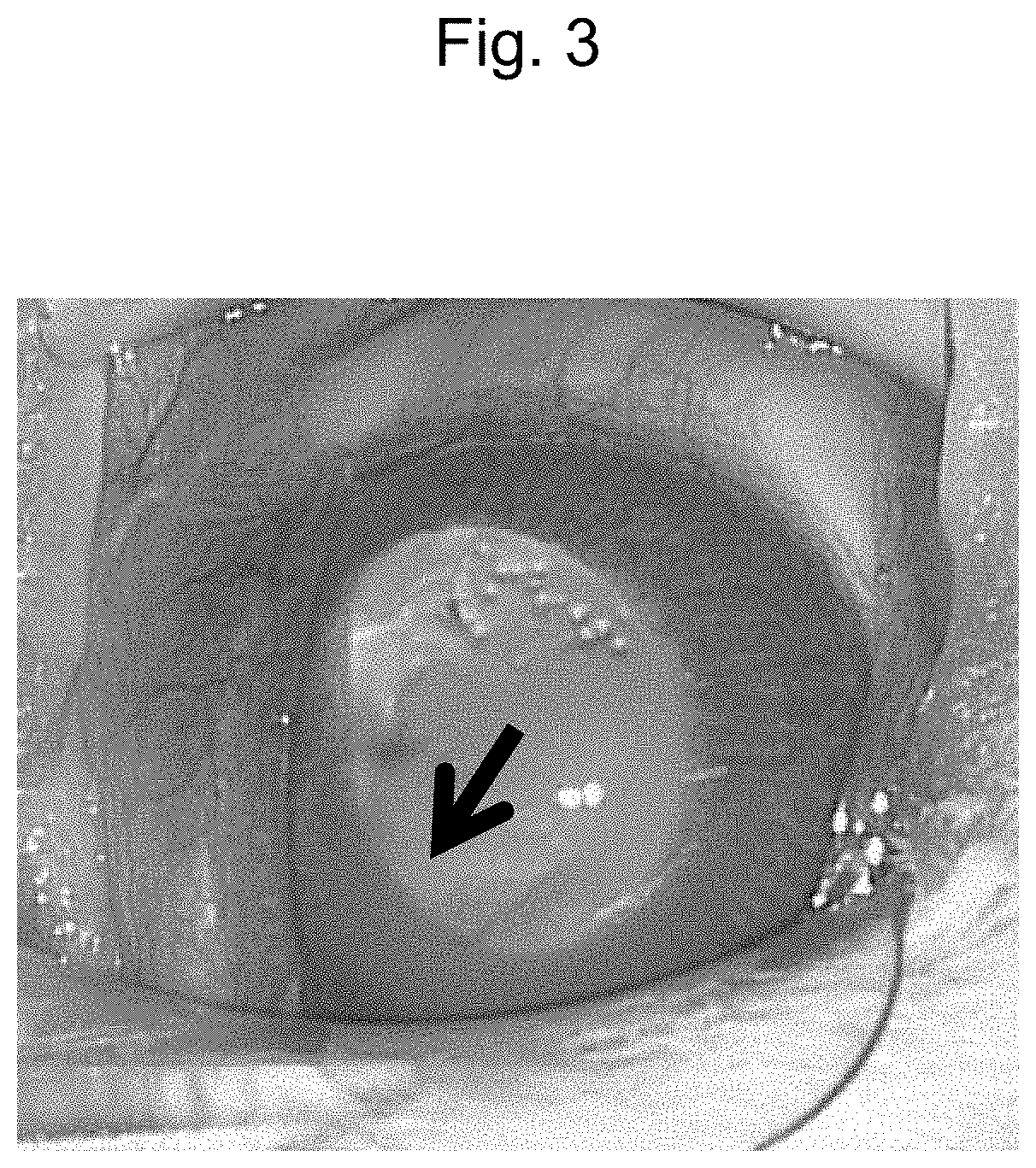 Hydrogen molecule-containing prophylactic or therapeutic agent for oxidative damage in intraocular surgeries