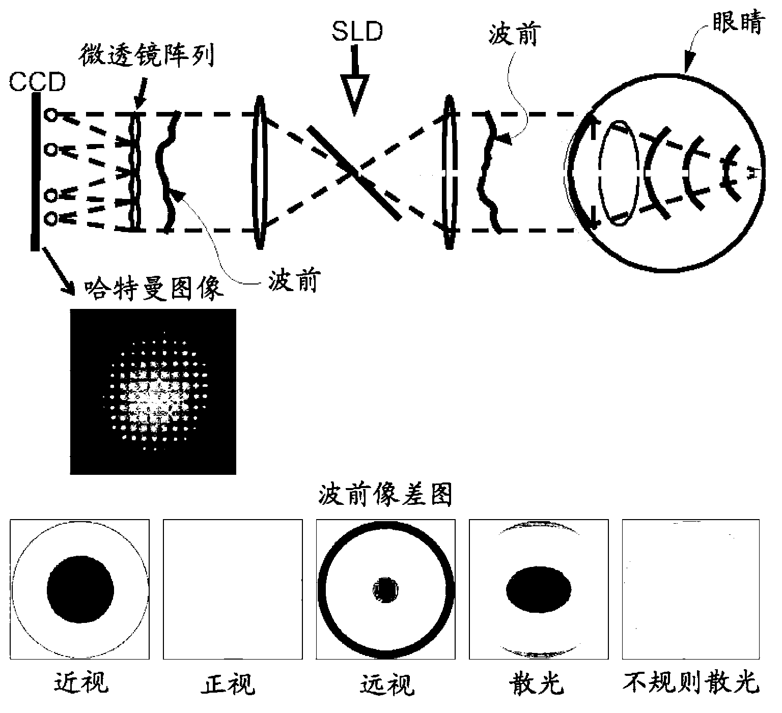 Contact lens for correction of irregular astigmatism